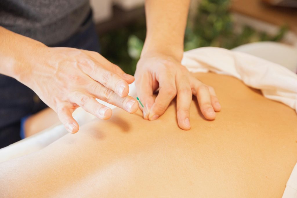 pexels photo 5473180 5473180 From above of crop anonymous man applying needles on back of client during acupuncture procedure
